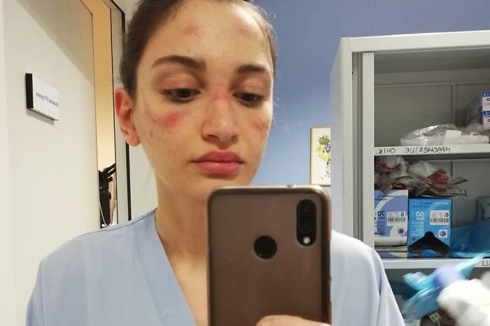 Nurse Treating Coronavirus Patients In Italy Shares How Hard It Is With A Heartbreaking Picture