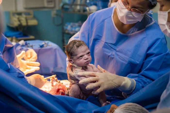“My Daughter Was Born a Ready Meme.” Baby Stares Down Doctors Just Moments After Birth