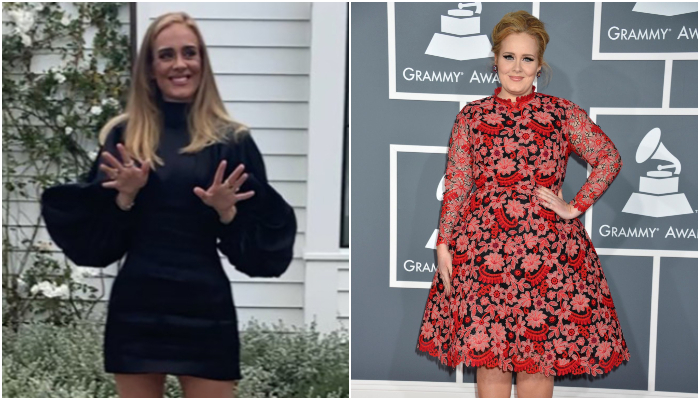 Experts Think Adele Got Some Cosmetic Help For Her Major Transformation
