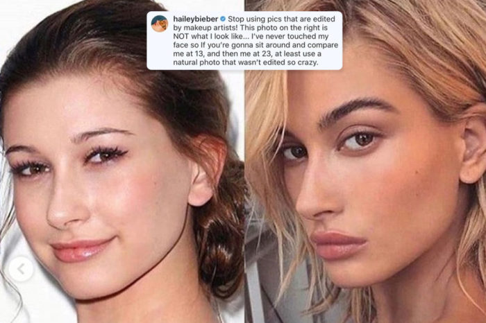 Hailey Baldwin finally spoke up about accusations she got plastic surgery