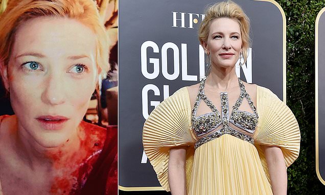 Oscar-winning actress Cate Blanchett suffers a head injury in a 'chainsaw accident'
