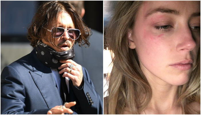 Amber Heard Allegedly Faked Bruises To Blackmail Johnny Depp
