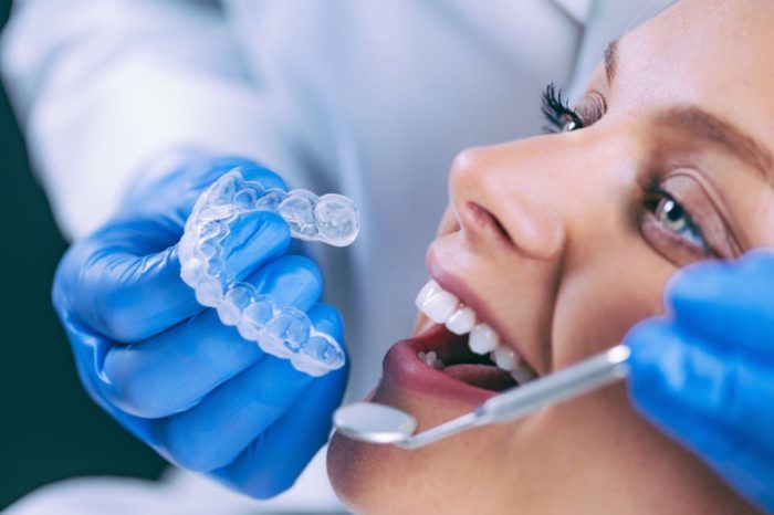 TikTok Trend Sees Teens Bleaching Teeth With Three Per Cent Hydrogen Peroxide